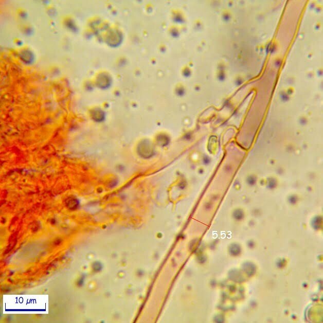 P. multizonata: Ife generatrici con giunti a fibbia